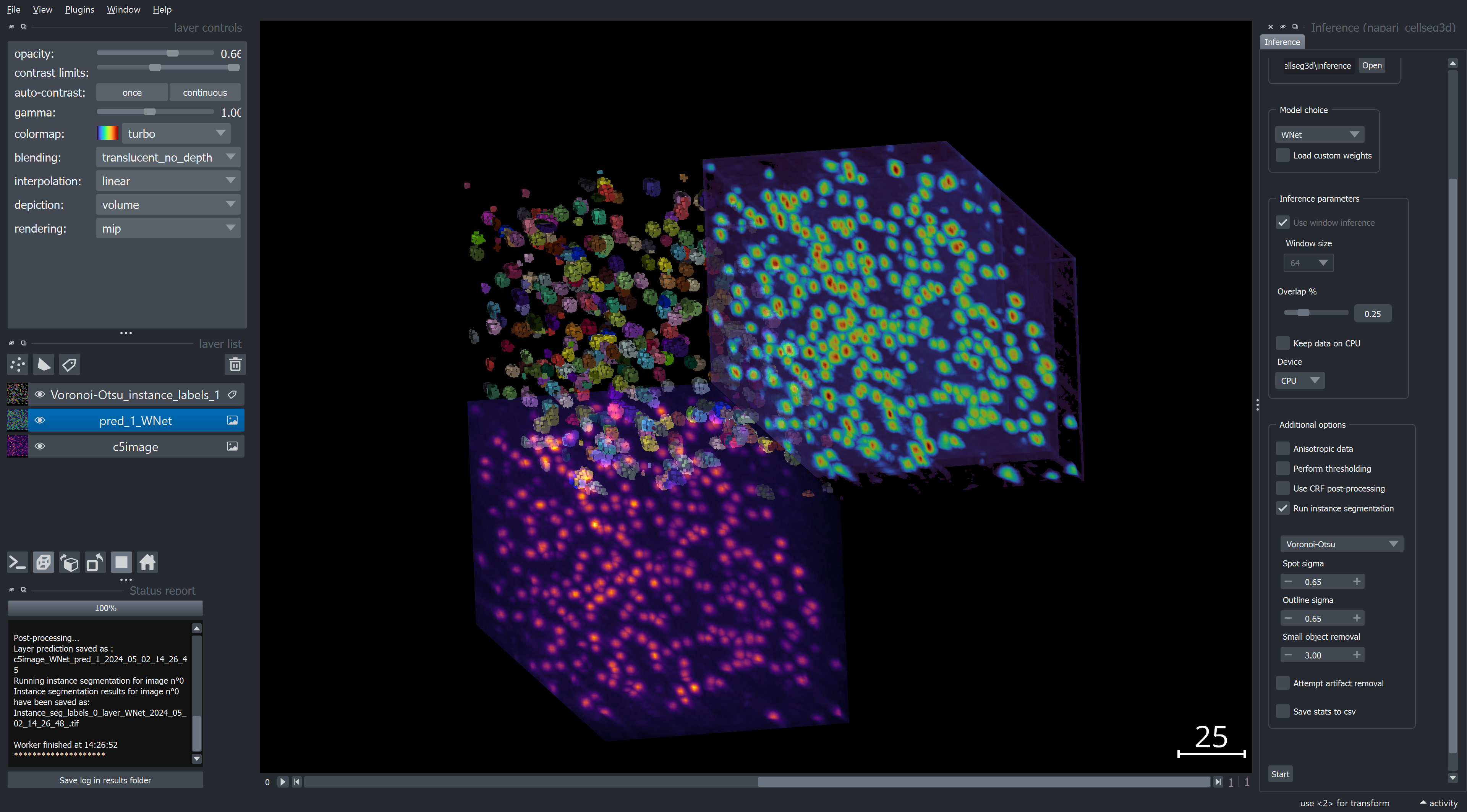 An example of inference with WNet3D on a 3D volume